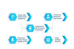 Pros and Cons of TMS Therapy